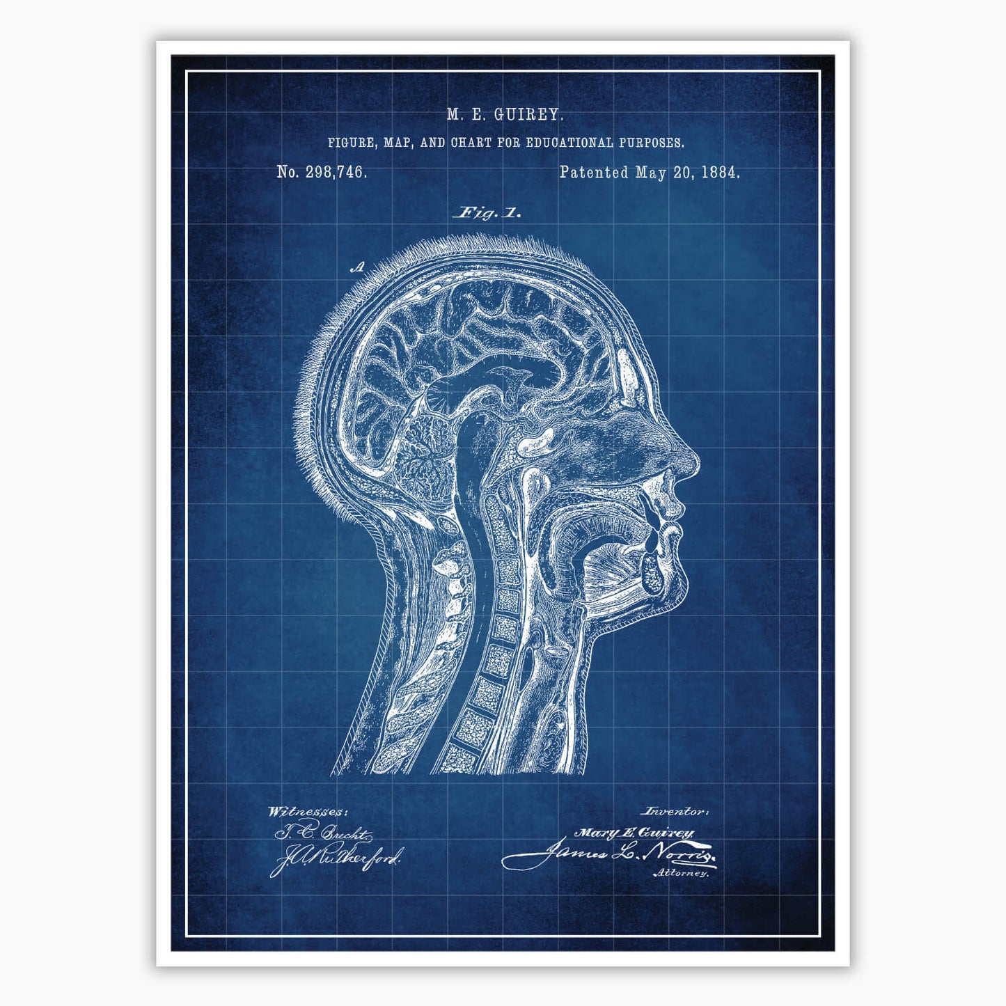 Anatomical Head Patent Poster