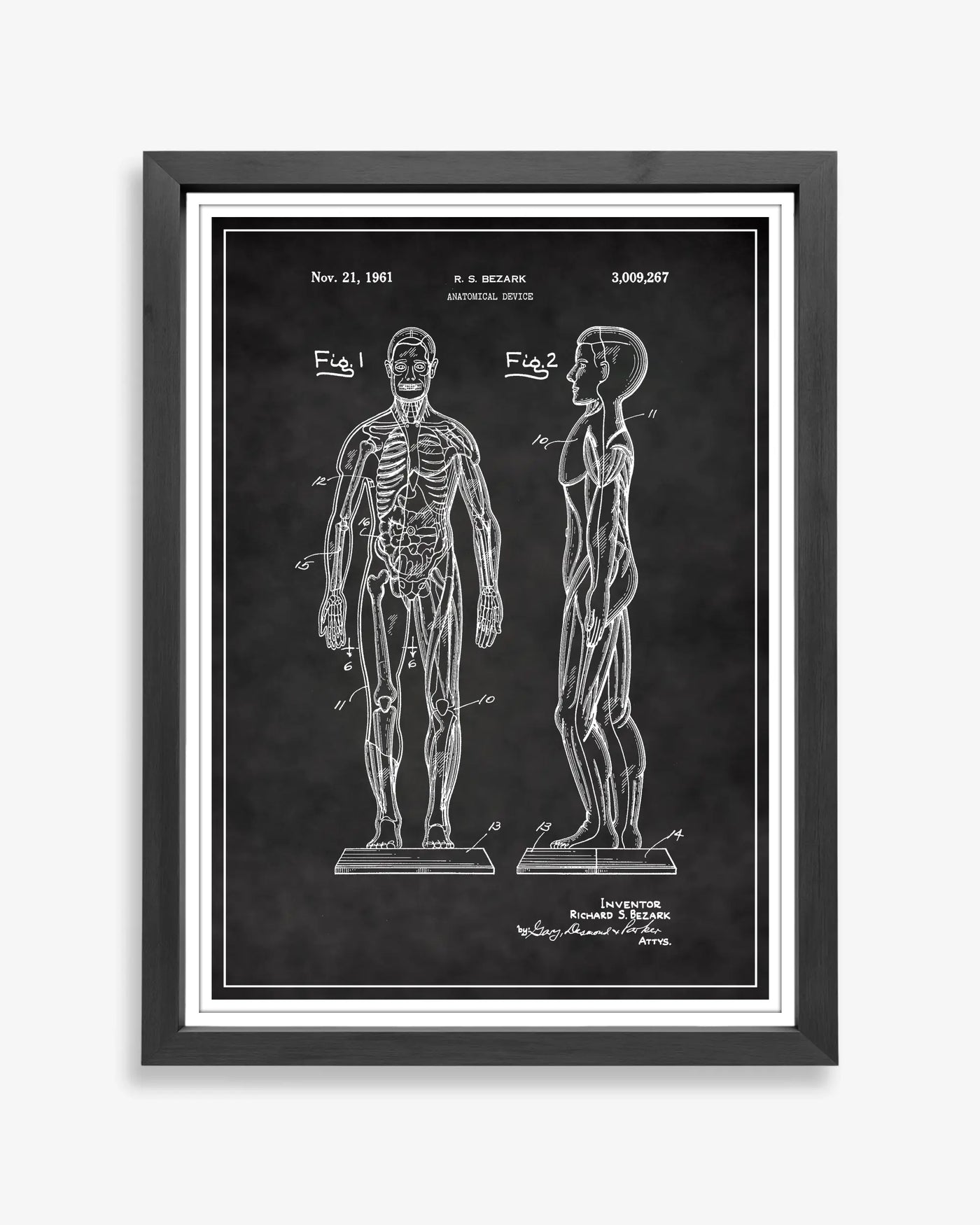 Anatomical Body design patent poster presented in chalkboard style, unframed and ready for display.