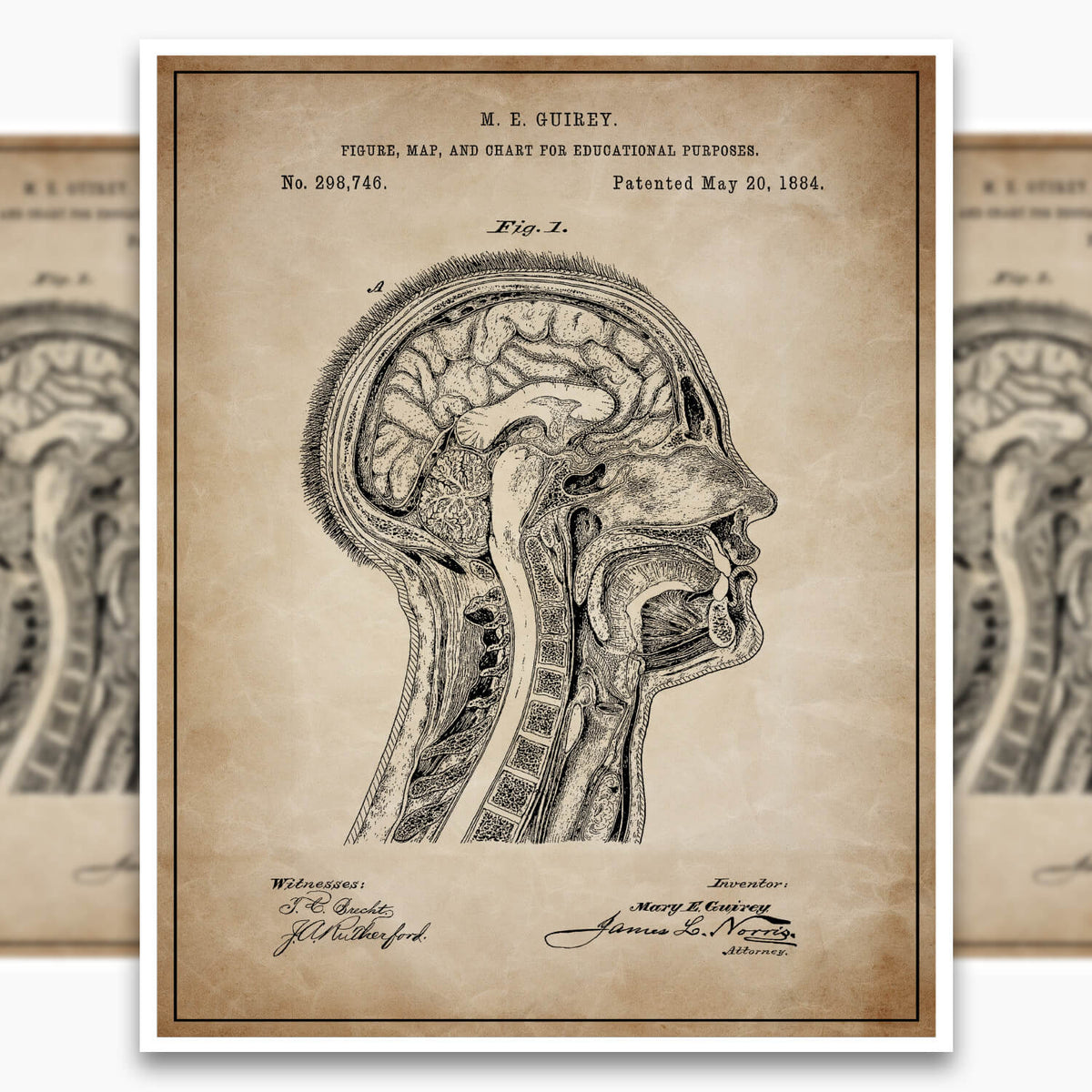Anatomical Head Patent Poster