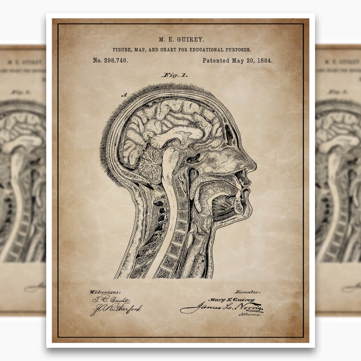 Anatomical Head Patent Poster