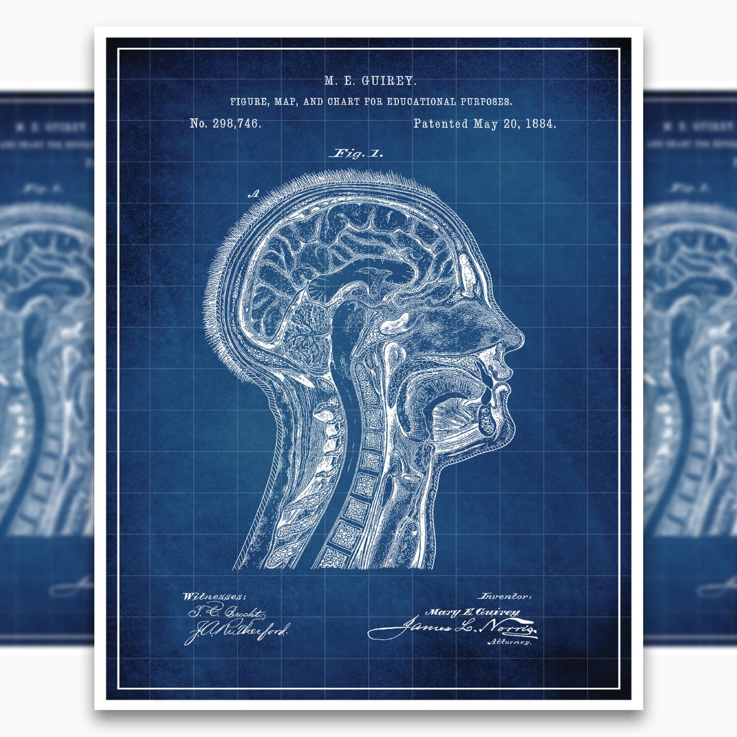 Anatomical Head Patent Poster