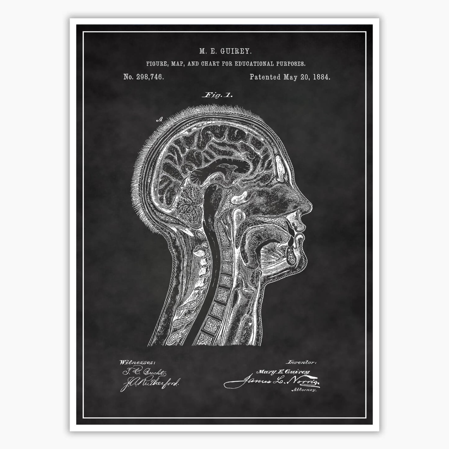 Anatomical Head Patent Poster