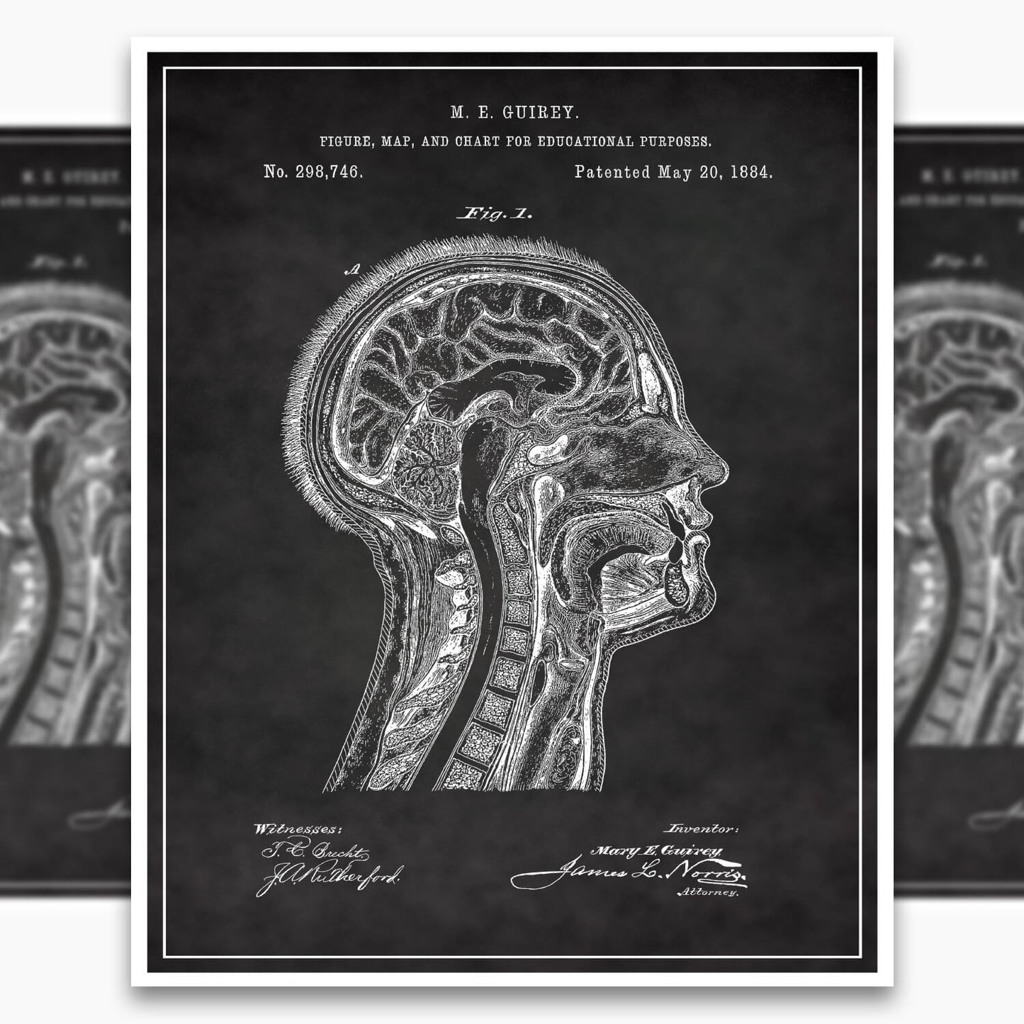 Anatomical Head Patent Poster