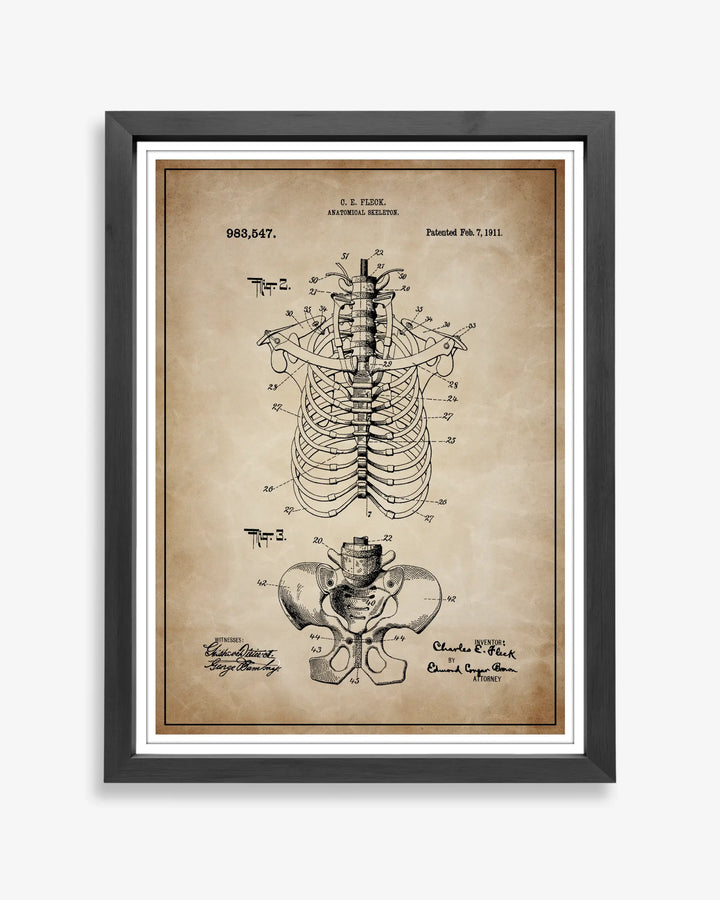 Anatomical Rib Cage design patent poster presented in antique parchment style, unframed and ready for display.