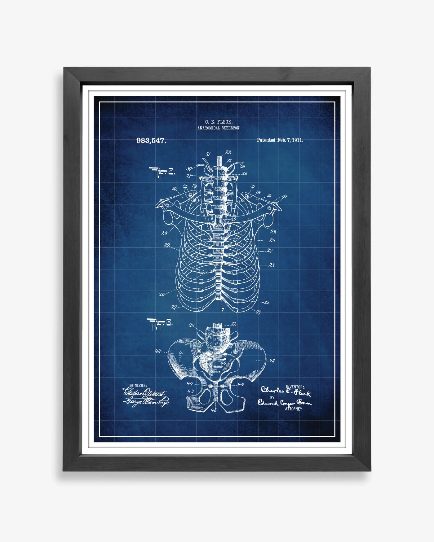 Anatomical Rib Cage patent poster in blueprint style, high-resolution unframed wall art.