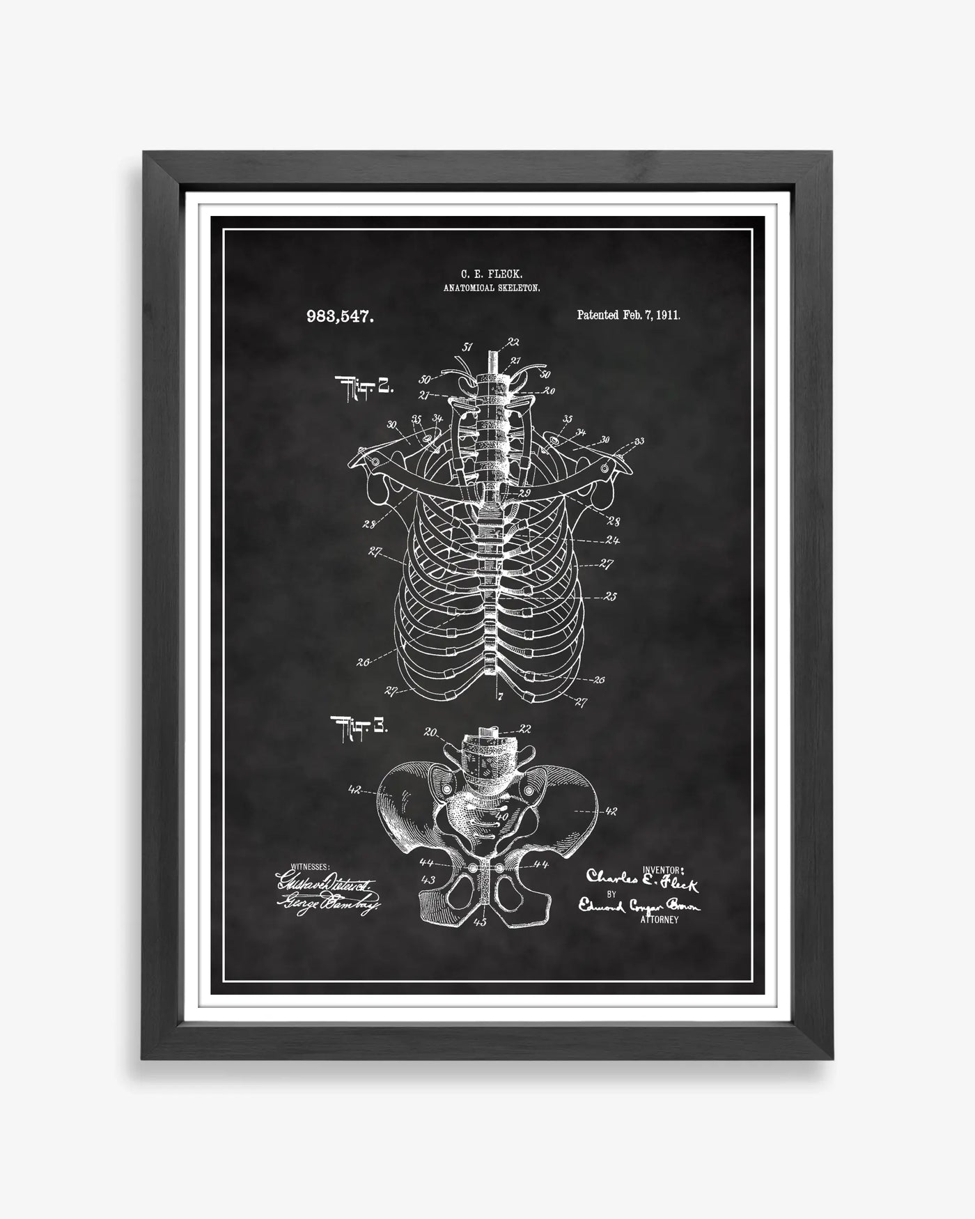 Unframed chalkboard style patent poster illustrating the Anatomical Rib Cage design.
