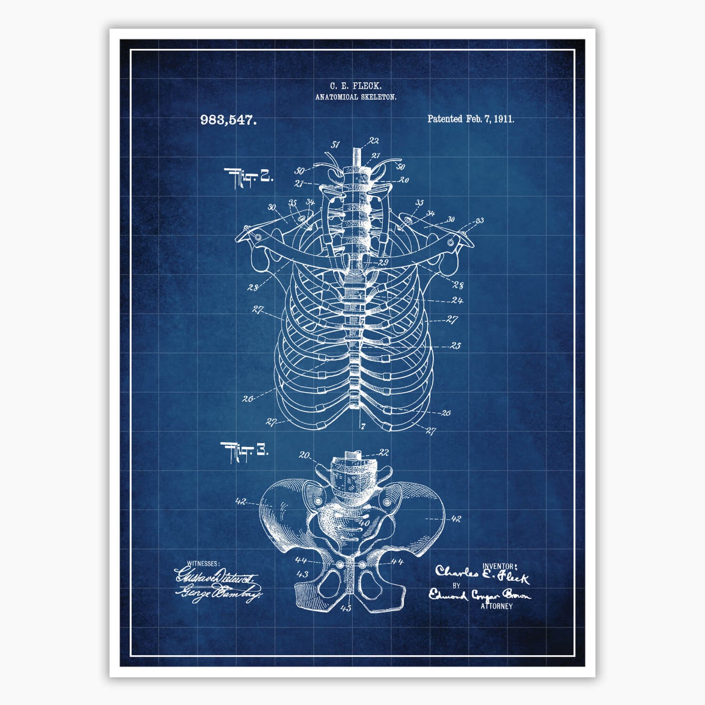 Anatomical Rib Cage Patent Poster