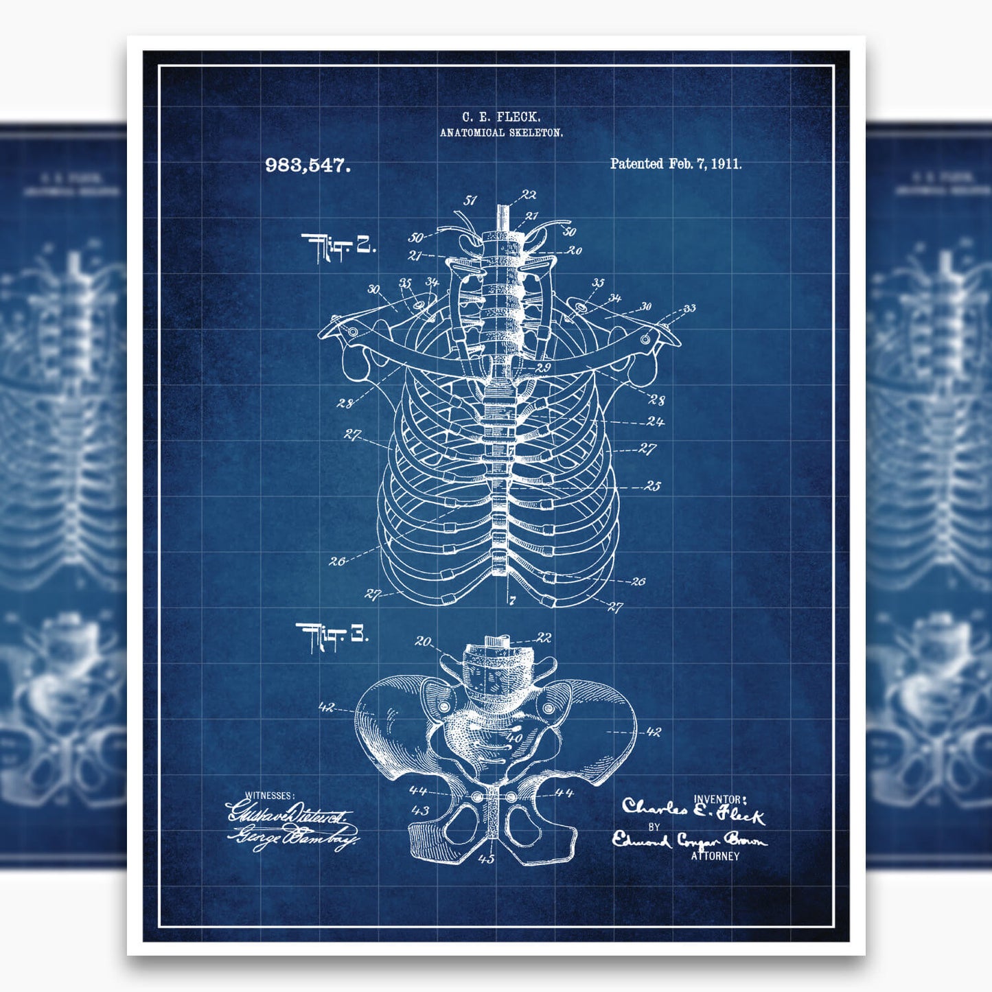 Anatomical Rib Cage Patent Poster