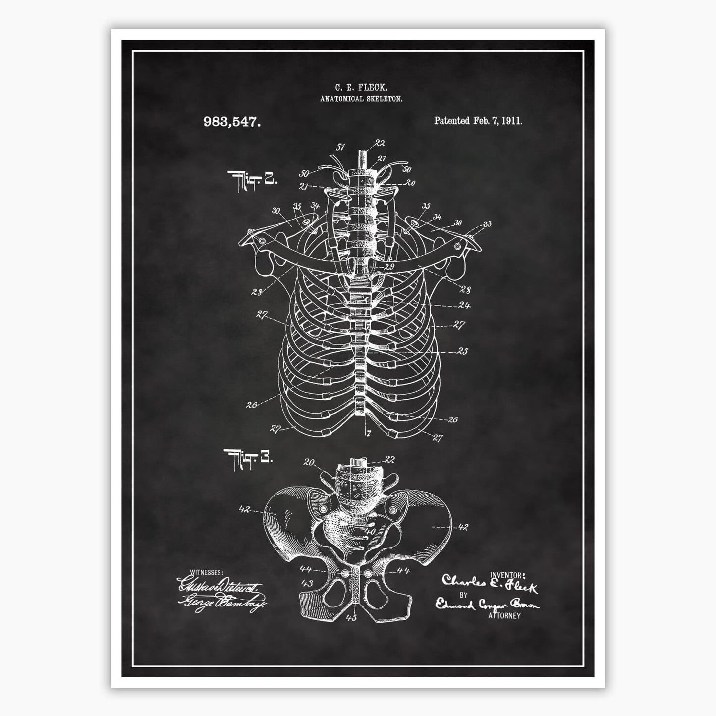 Anatomical Rib Cage Patent Poster