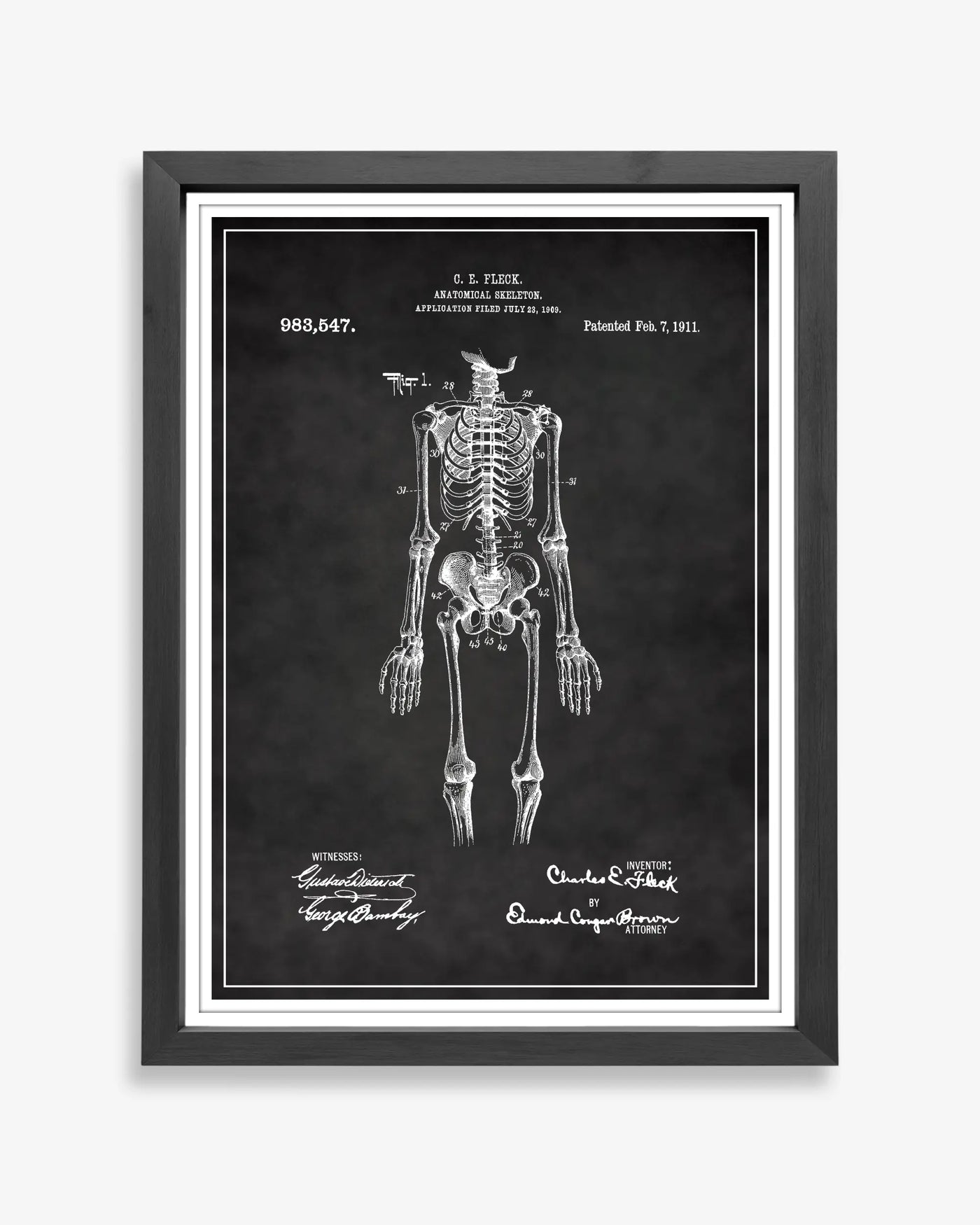 Anatomical Skeleton patent poster in chalkboard style, high-resolution unframed wall art.
