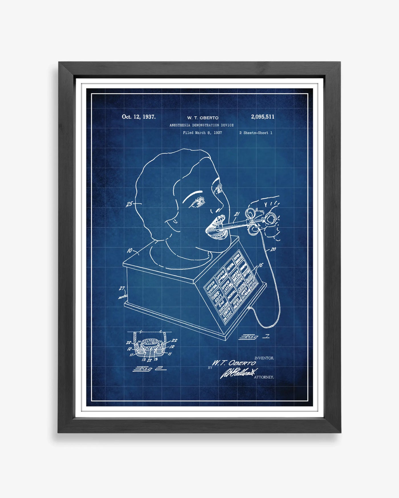 Anesthesia Device patent poster in blueprint style, high-resolution unframed wall art.
