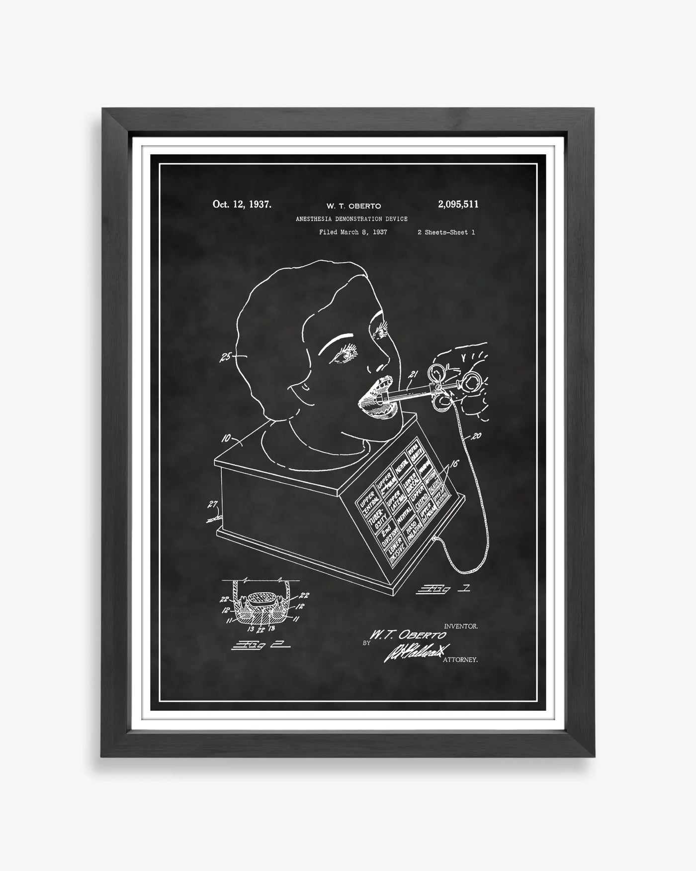 Unframed wall art featuring the Anesthesia Device patent poster in a chalkboard finish.