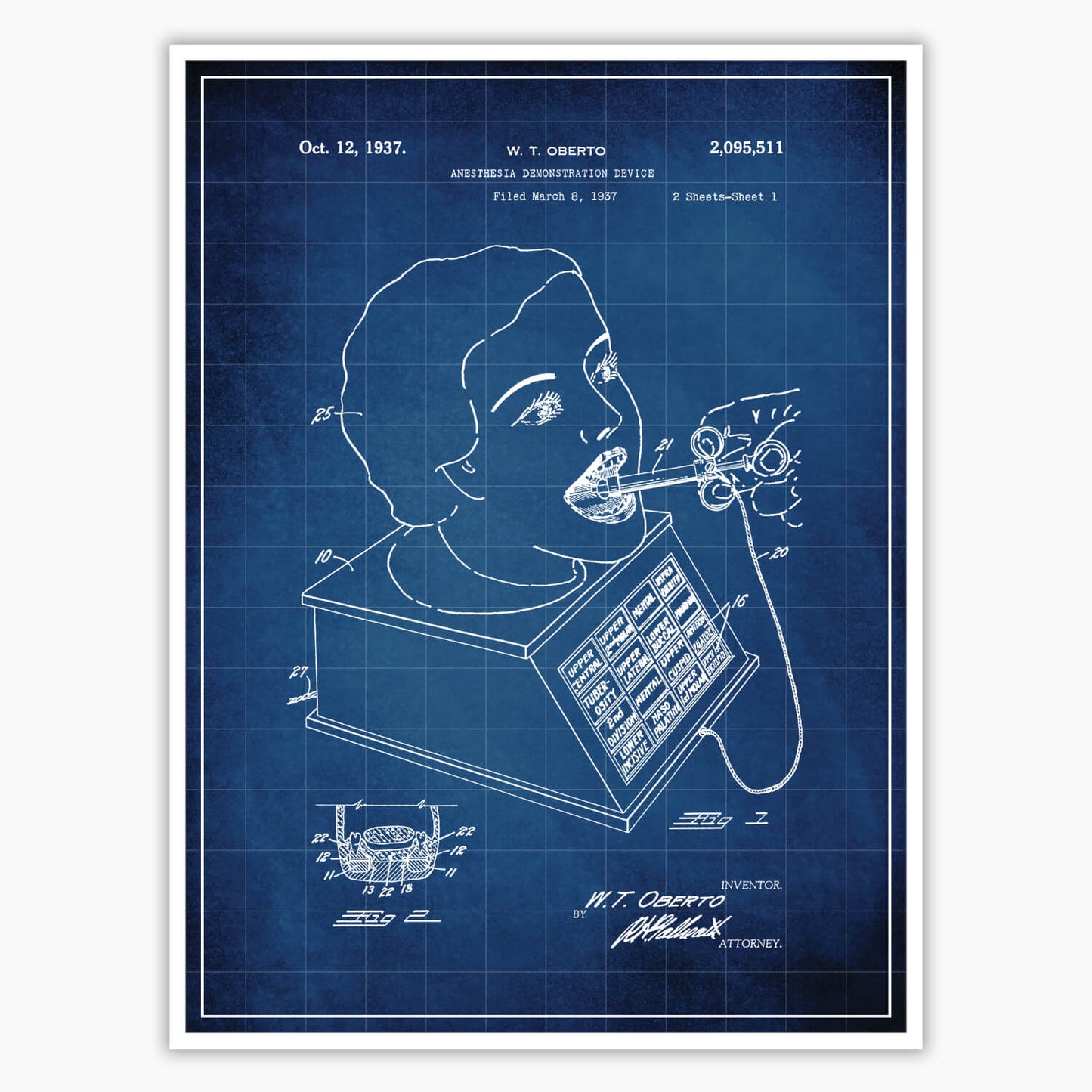 Anesthesia Device Patent Poster