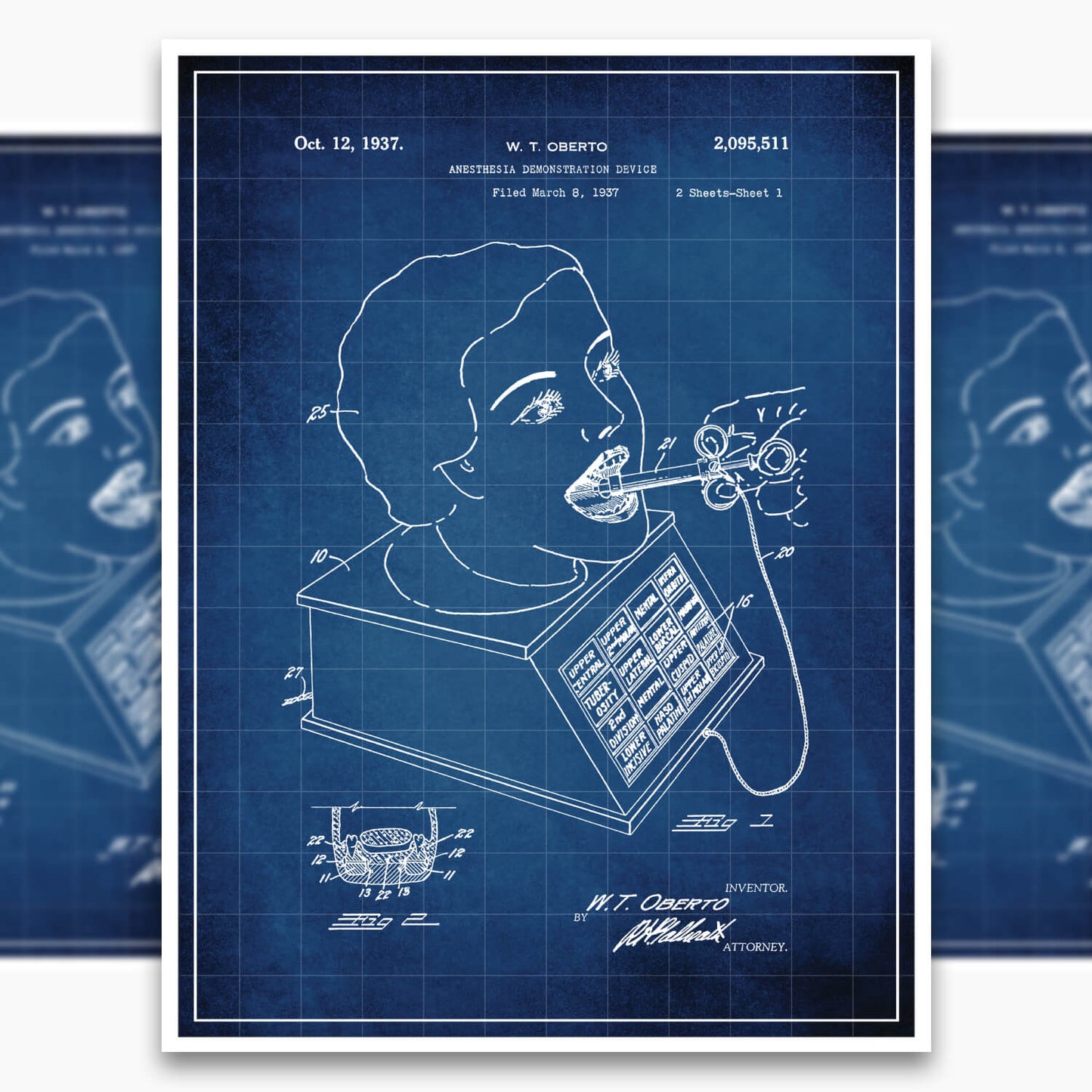 Anesthesia Device Patent Poster