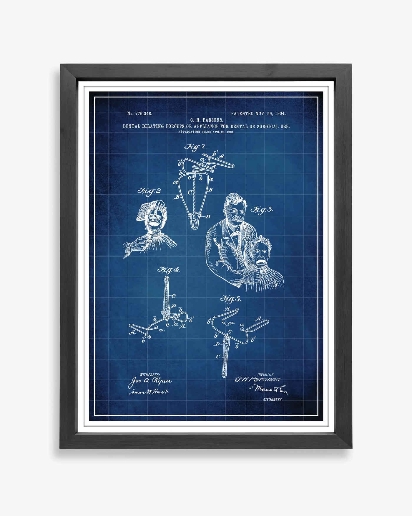 Dental Forceps design patent poster presented in blueprint style, unframed and ready for display.