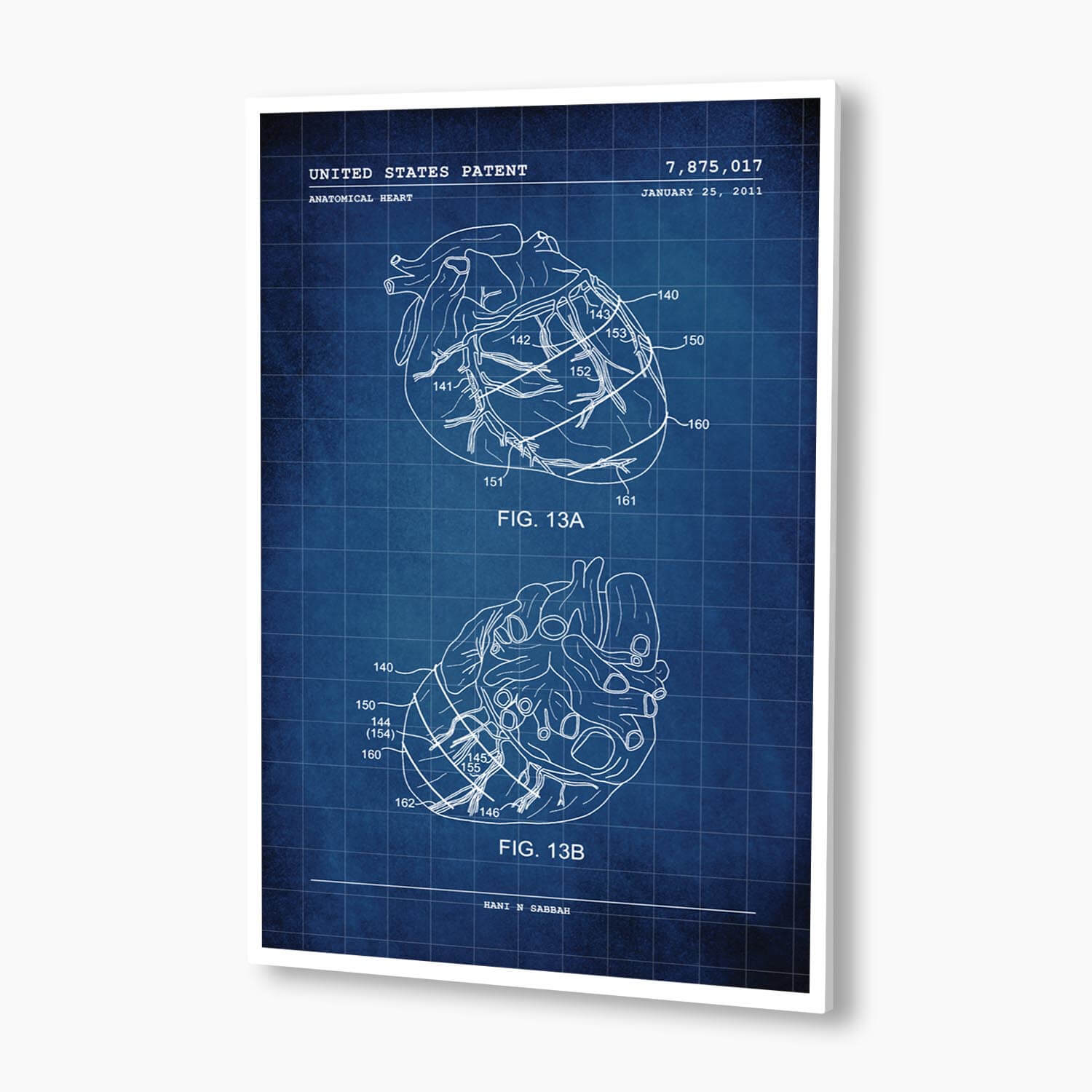 Anatomical Heart Patent Poster; Patent Artwork